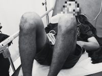 Insiden Berdarah Awal 2026, Polisi Selidiki Penusukan Pria di Pelabuhan Rambang